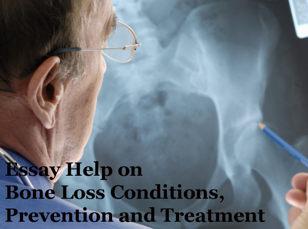 Essays on loss prevention